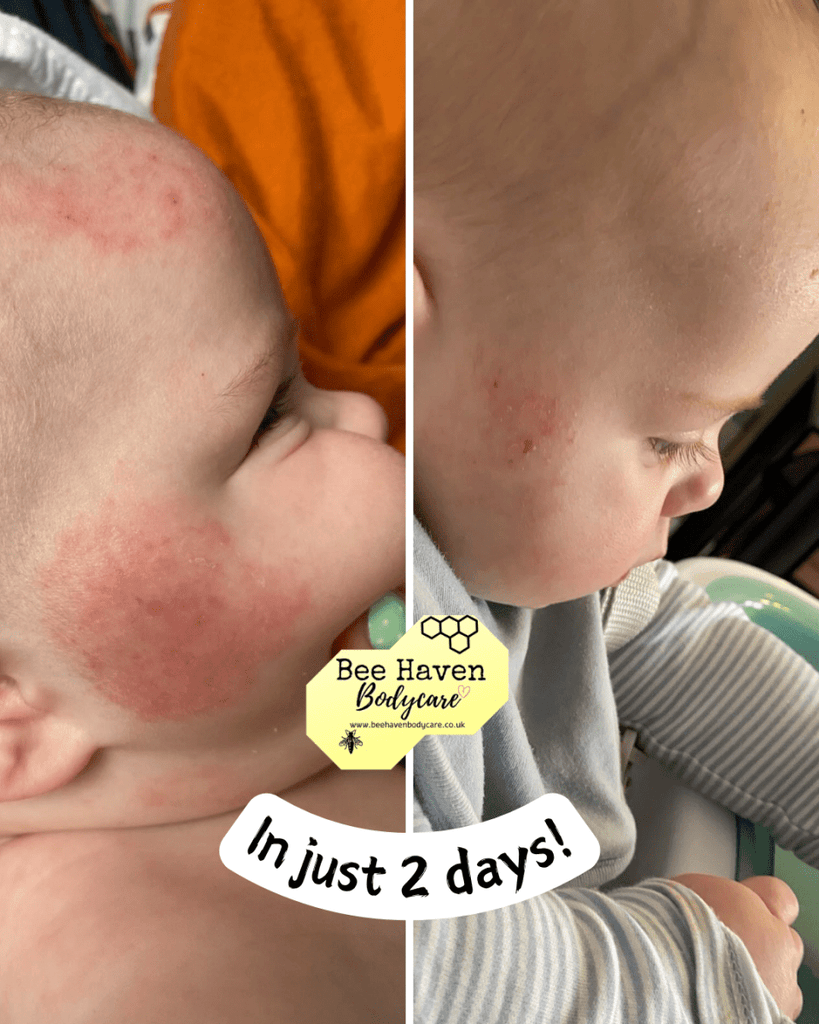 Baby Skincare - Bee Haven Bodycare & Gifts
