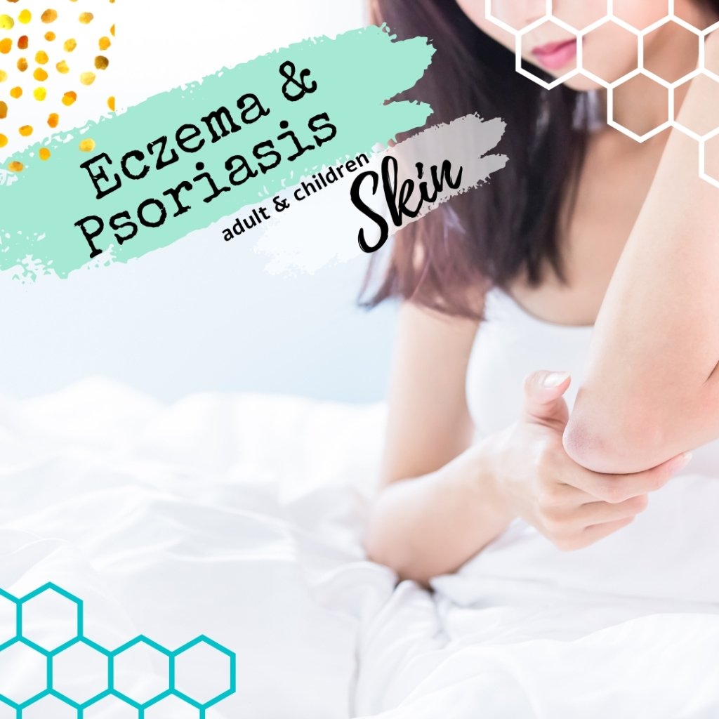 Eczema & Psoriasis Skin Advice - Bee Haven Bodycare & Gifts