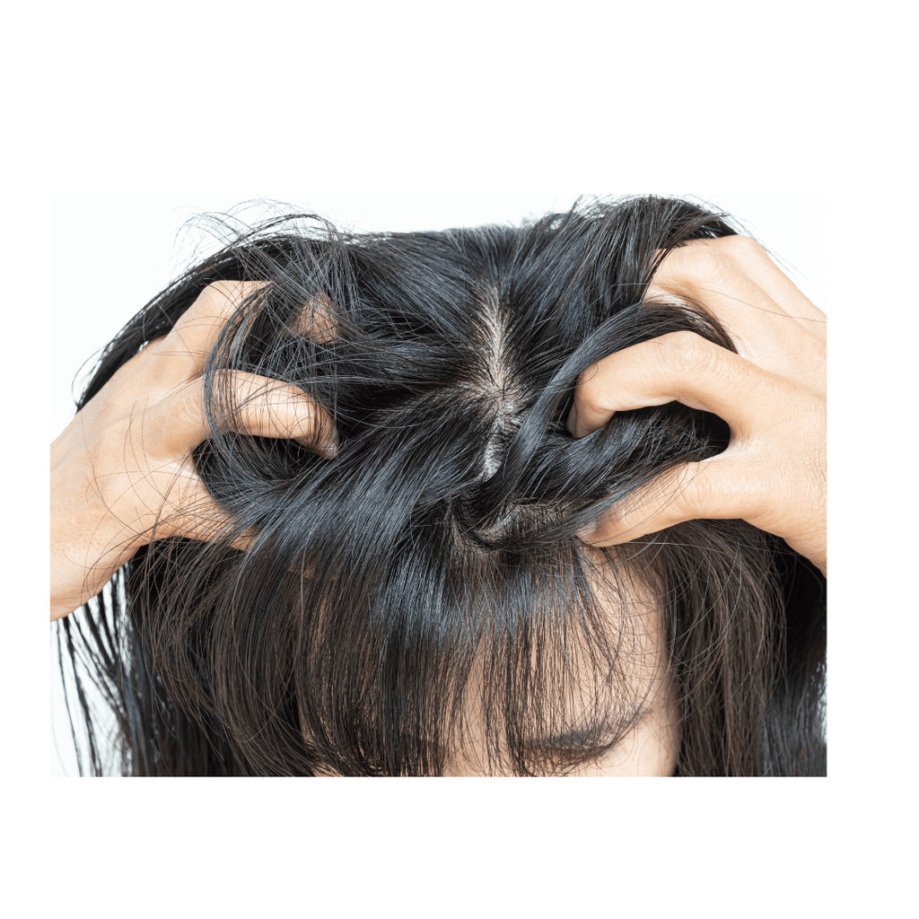 ITCHY, FLAKY SCALP - Bee Haven Bodycare & Gifts